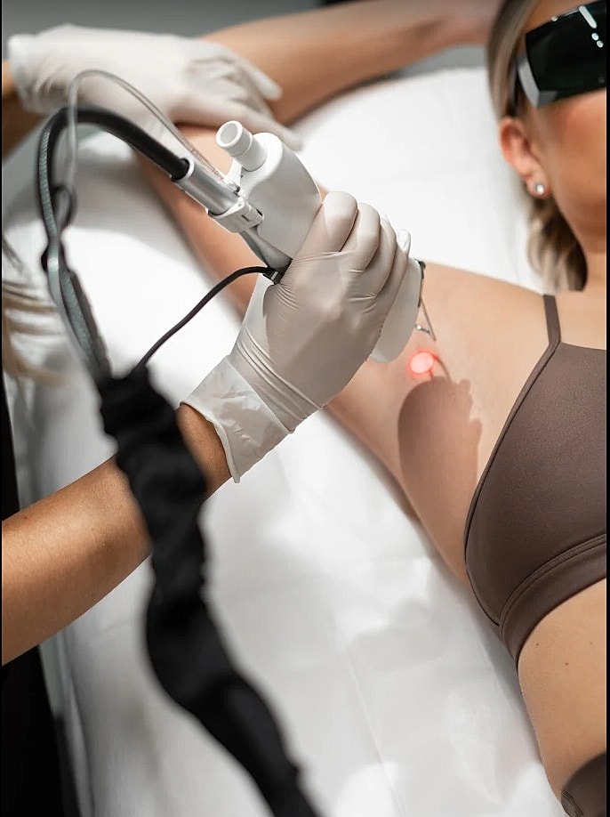 Laser Hair Removal Pre-Treatment Checklist