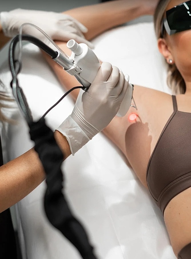 Laser hair removal treatment in progress.