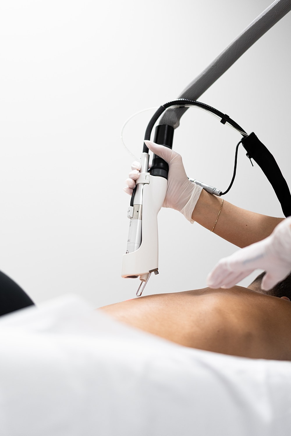 Laser treatment on a patient's back in clinic.